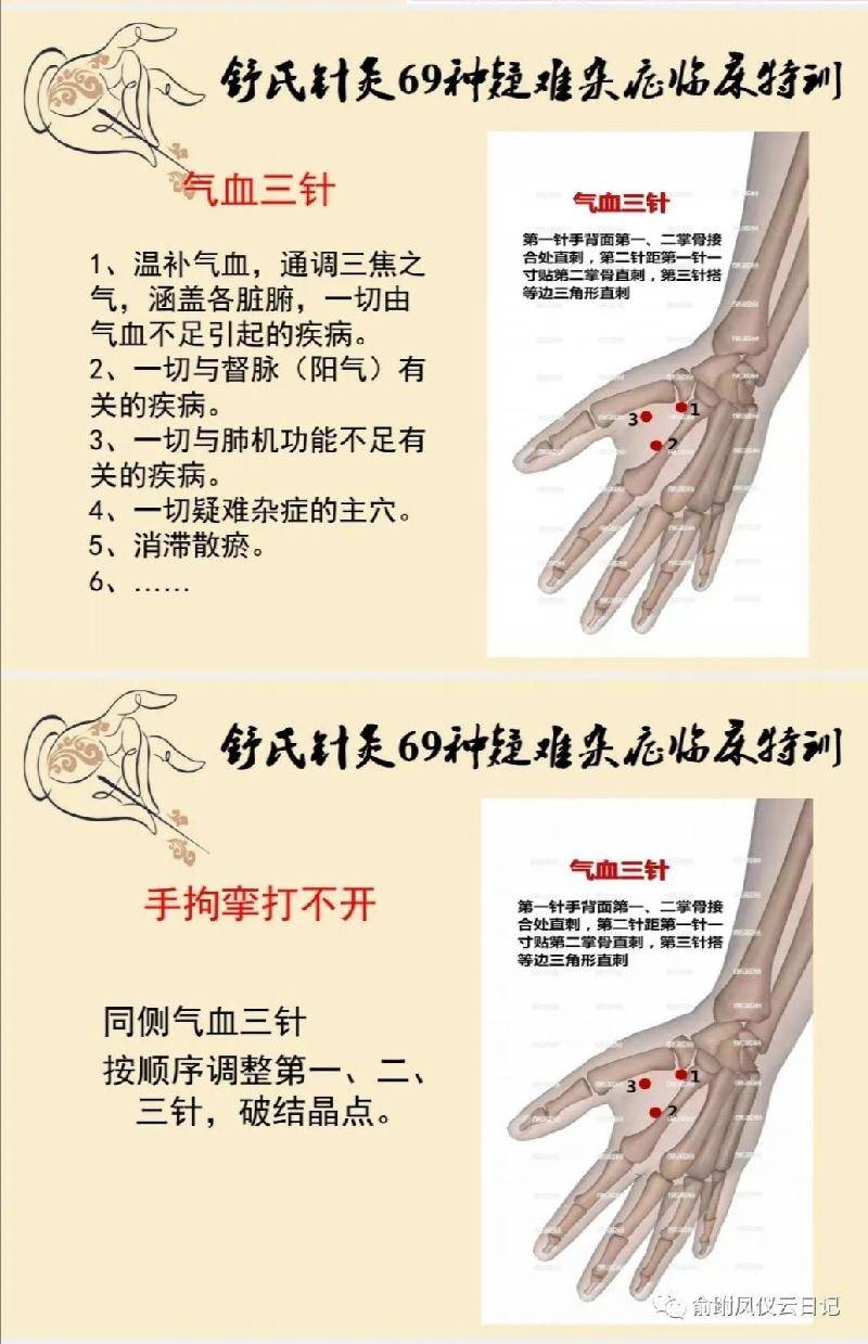 气血三针,调一切由气血不足引起的疾病