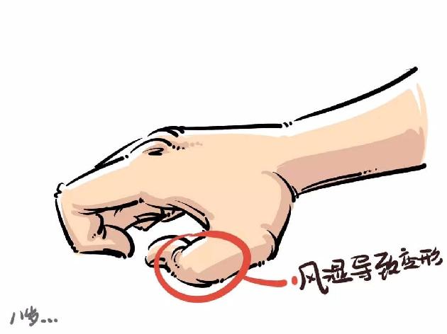 类风湿关节炎的调理方法(图2)