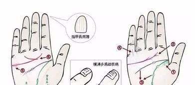 掌纹竟可以诊断肝癌、糖尿病、高血压、妇科病、脑溢血!(图25)