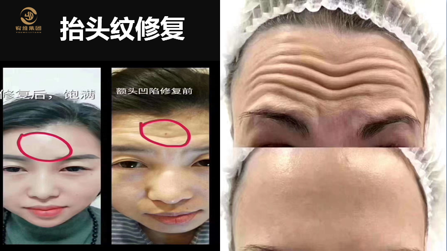 011.png