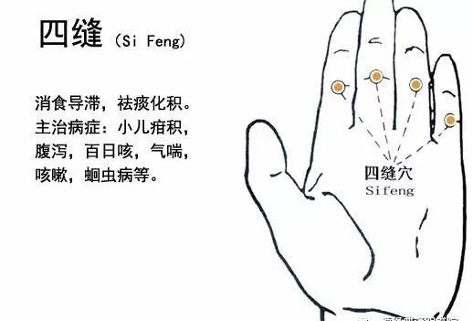 【针灸】“扎四缝”的妙用(图3)