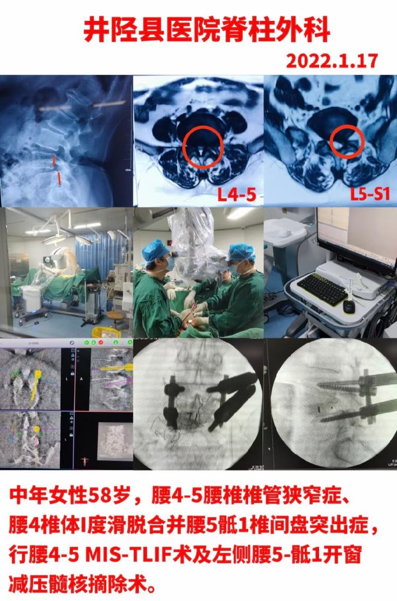 闻骨科病友赞李院长｜作者：李帆（图2）