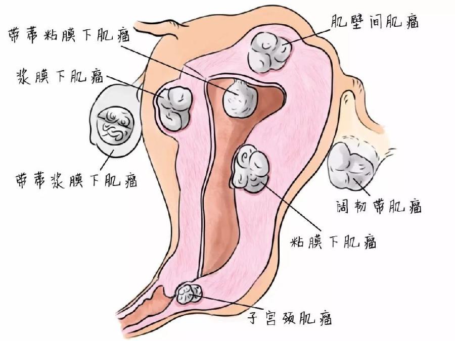 盛開在白色戰線上的格桑花——记界首市人民醫院腫瘤科副主任醫師房淑华（图3）
