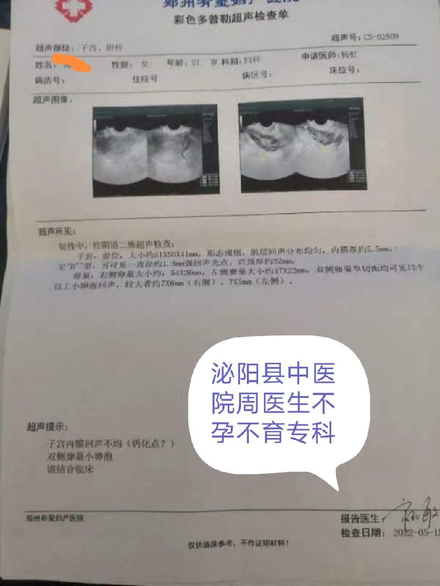 多囊女生不是因为雌激素不够才月经不调的!