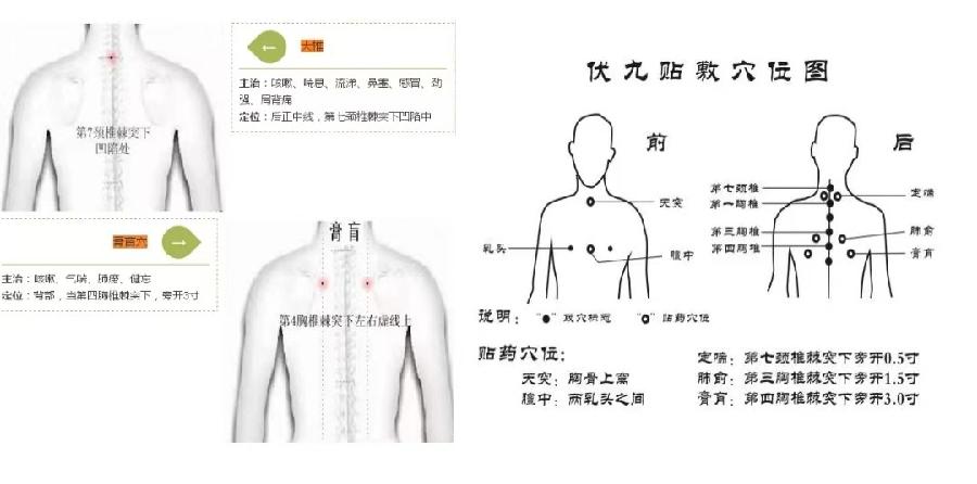【中艾国灸】七律•驱寒补阳三伏灸（组诗）作者：冷军油（张富贵）北京头条•西安头条•都市头条发布！（图25）