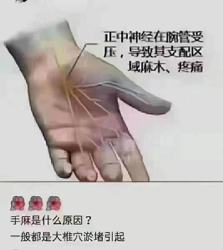 双手麻是淤堵经络不通（图3）