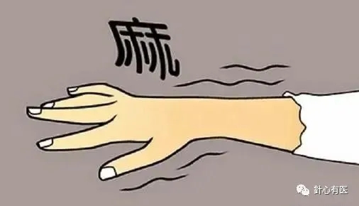 双手麻是淤堵经络不通（图5）