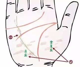 24种疾病的手诊特征（图2）