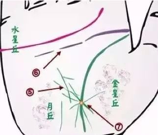 24种疾病的手诊特征（图3）