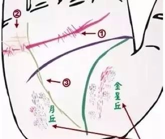 24种疾病的手诊特征（图4）