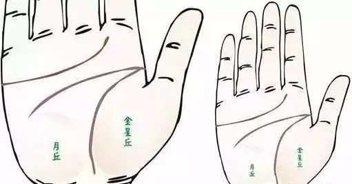 24种疾病的手诊特征（图5）