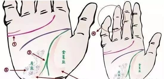 24种疾病的手诊特征（图7）