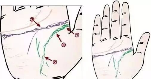 24种疾病的手诊特征（图9）