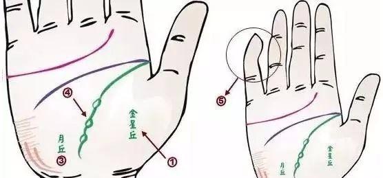 24种疾病的手诊特征（图10）