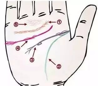 24种疾病的手诊特征（图14）