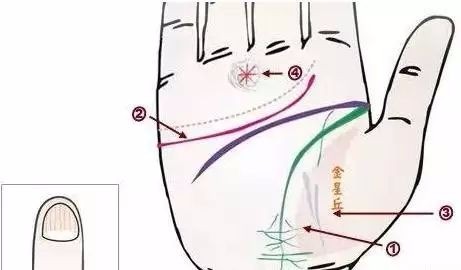 24种疾病的手诊特征（图16）