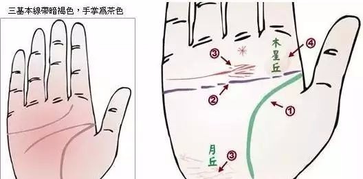 24种疾病的手诊特征（图17）