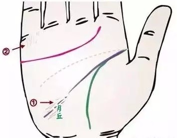 24种疾病的手诊特征（图19）