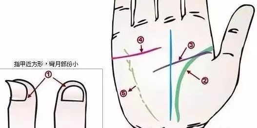 24种疾病的手诊特征（图21）