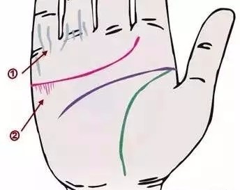 24种疾病的手诊特征（图22）