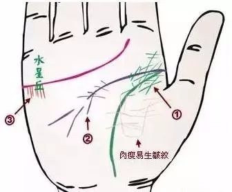 24种疾病的手诊特征（图23）