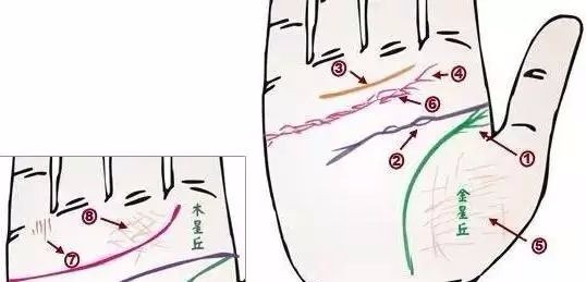24种疾病的手诊特征（图24）