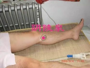 各种痛症的针灸治疗 ( 图解)(图2)