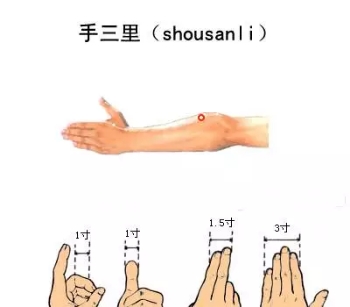 各种痛症的针灸治疗 ( 图解)(图7)