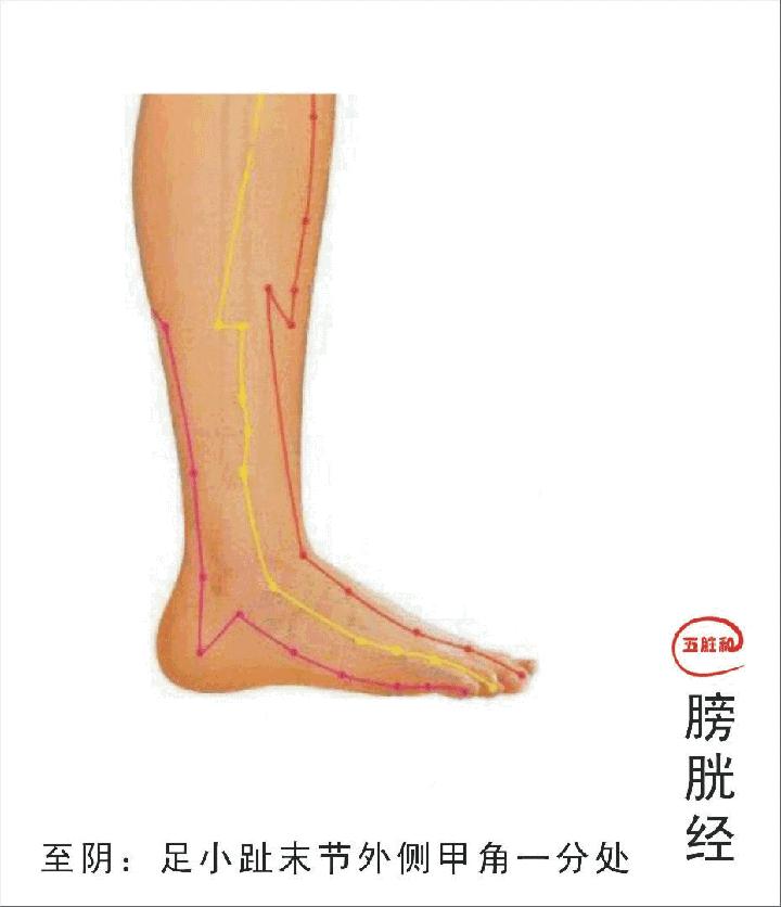 各种痛症的针灸治疗 ( 图解)(图14)