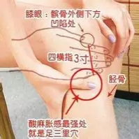 各种痛症的针灸治疗 ( 图解)(图18)