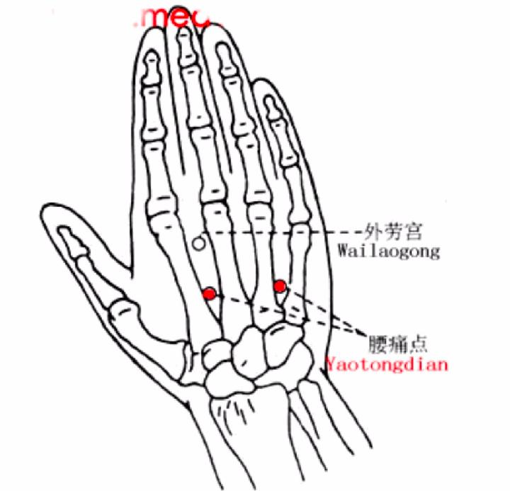 各种痛症的针灸治疗 ( 图解)(图19)