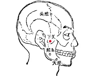 各种痛症的针灸治疗 ( 图解)(图20)