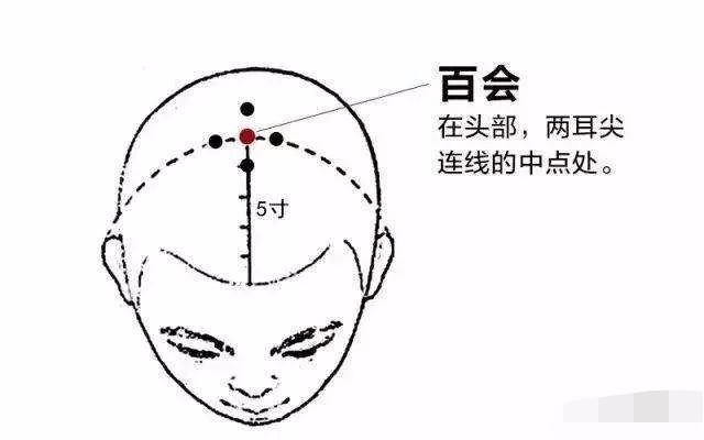 胆小的气虚、肿眼泡的有痰湿、怕冷的呢？（图4）