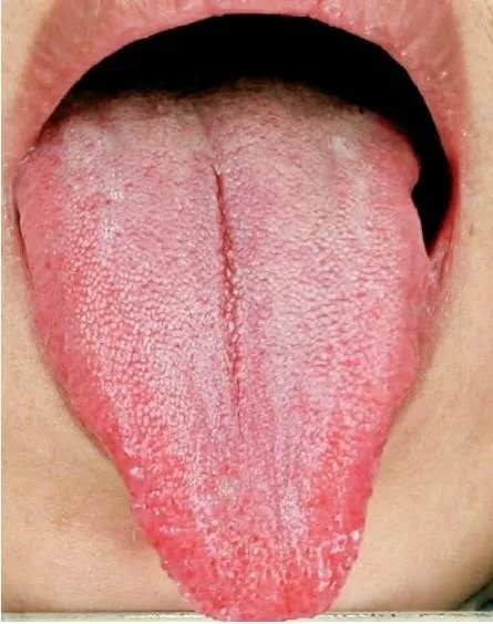 董洪涛:肝郁脾虚是什么病?(图2)