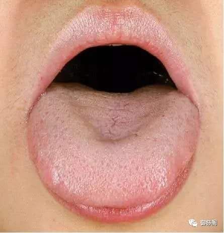 董洪涛:肝郁脾虚是什么病?(图3)