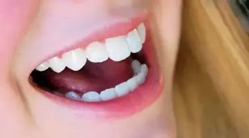 口臭的中医疗法：从《黄帝内经》中悟出的妙方（图2）