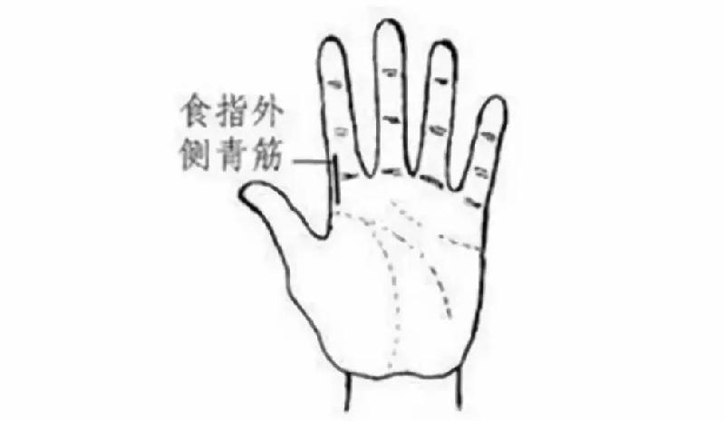 有一种手诊法,一上手就知道是什么病!(图3)