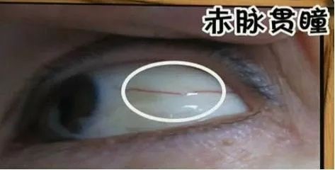 目诊 - 看你的眼就知你的病（图12）