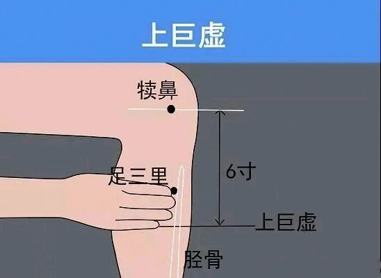 董氏针法:足三里.上巨虚歪二针.颞三针治疗面瘫口眼歪斜特效_北京头条