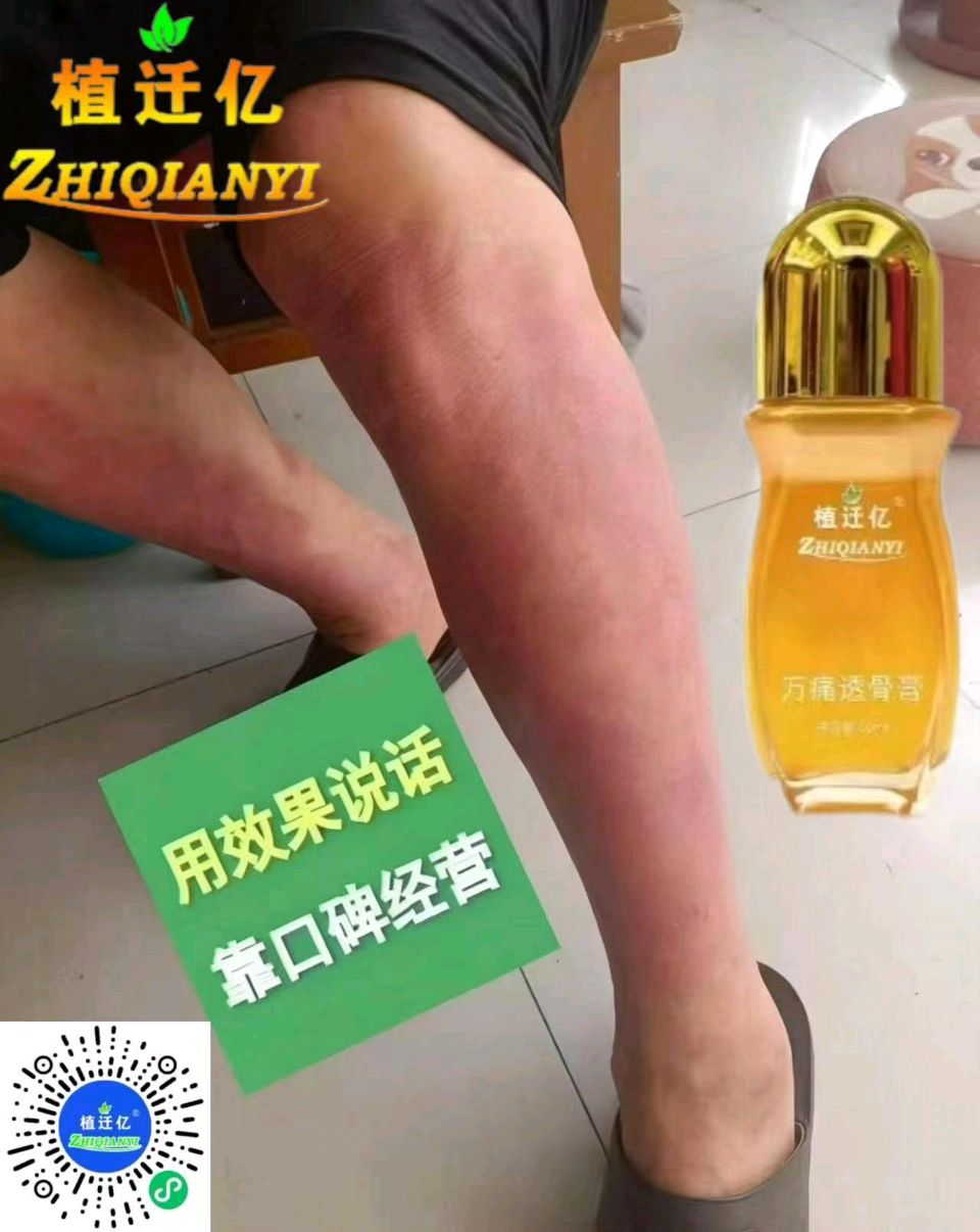 【慧眼识好物】植迁亿:万通透骨膏，调理见良效（图3）