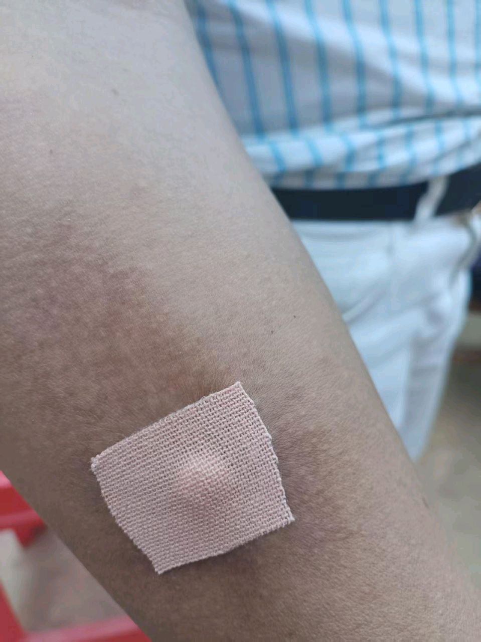 萧剑慧医师:我用蚂蟥治血栓（图4）