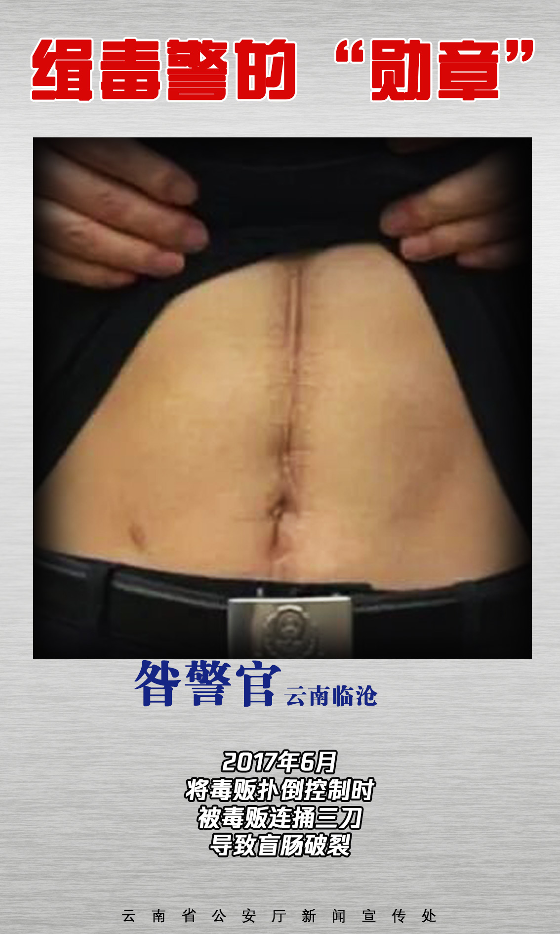 云南公安‖缉毒警的伤疤，是摘不掉的“勋章”（图8）