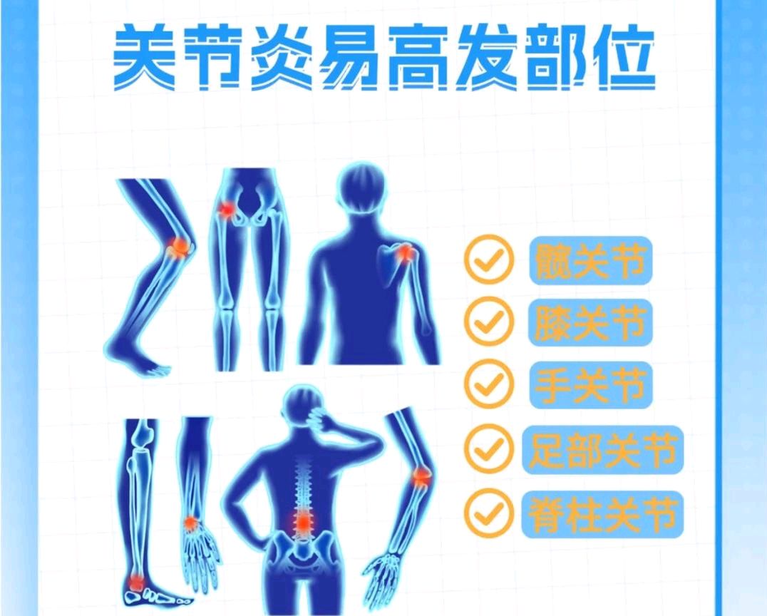 【散文】《骨与关节的回声: 在十月十二日听见身体的低语——写在第三十个世界关节炎日暨世界骨关节炎关注日》作者: 强军/陕西宝鸡（图9）
